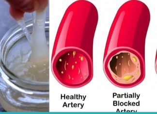სუფთა სისხლძარღვები: 5 ოქროს რეცეპტი ექიმბაშებისგან