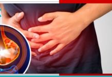 შეიმსუბუქეთ გასტრიტის სიმპტომები ამ ბუნებრივი საშუალებებით