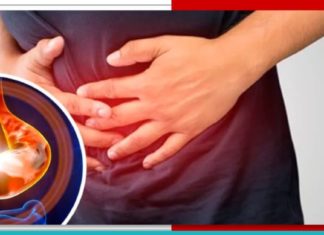 შეიმსუბუქეთ გასტრიტის სიმპტომები ამ ბუნებრივი საშუალებებით