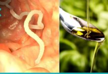 გინდათ მოიშოროთ პარაზიტები ორგანიზმიდან? გაეცანით ამ 4 რეცეპტს