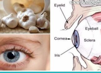 როგორ აღვიდგინოთ მხედველობა ნივრის მეშვეობით, ოპერაციის გარეშე!