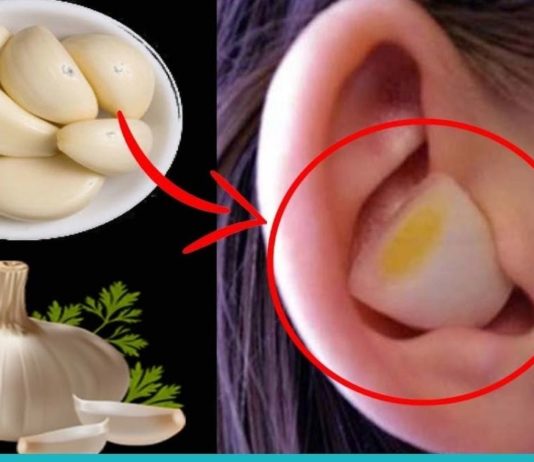 მან ნიორი ყურში ჩაიდო! ამ მეთოდმა ავადმყოფობას გადამარჩინა