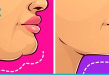 5 ეფექტური საშუალება ღაბაბის მოსაშორებლად