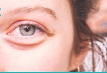 ყველაზე მარტივი მეთოდი თვალების ქვეშ ტომრების მოსაშორებლად