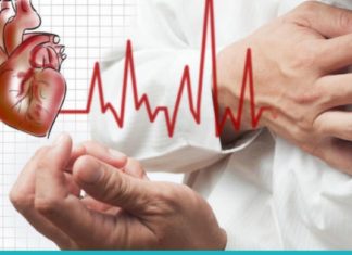 არითმია: მთავარი რამ, რაც უნდა იცოდეთ