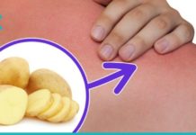 დაგიგროვდათ მარილები კისრის არეში? უმკურნალეთ მას ამ მეთოდით