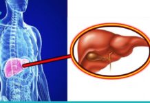 Როგორ დავეხმაროთ ღვიძლს: ბუნებრივი გზები