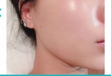 კოლაგენის გამაახალგაზრდავებელი საშუალება სახისა და კისრისთვის.