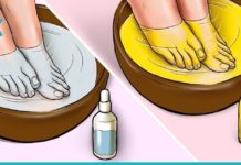 თურმე ფეხის სოკოს სამკურნალო 2 ინგრედიენტი სახლში გვქონია! – ასე სოკოს 2 დღეში მოიშორებთ