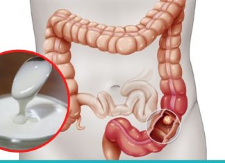 3 აუცილებელი პროდუქტი ნაწლავის ფლორის აღსადგენად