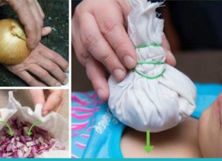 ჯანმრთელობის 7 პრობლემა, რომლის დროსაც ხახვი დაგეხმარებათ