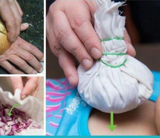 ჯანმრთელობის 7 პრობლემა, რომლის დროსაც ხახვი დაგეხმარებათ