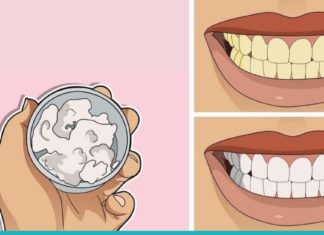 სახლში დამზადებული კბილის პასტა- ათეთრებს კბილებს, მკურნალობს კარიესს და ღძილების დაავადებებს