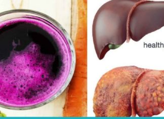 გაიწმინდეთ ამ ნატურალური სასმელით ღვიძლი