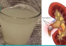 როგორ დავშალოთ თირკმელებში კენჭები? თქვენ ეს უნდა იცოდეთ!