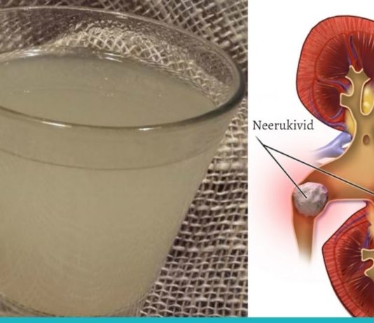 როგორ დავშალოთ თირკმელებში კენჭები? თქვენ ეს უნდა იცოდეთ!