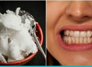 რითი ჯობია ქოქოსის ზეთი ჩვეულებრივ კბილის პასტას? პასუხი მარტივია!