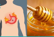 განიკურნეთ გასტრიტისგან თაფლის დახმარებით