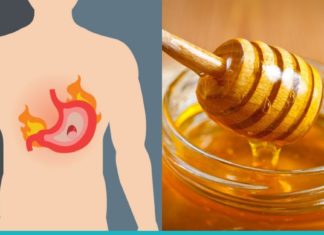 განიკურნეთ გასტრიტისგან თაფლის დახმარებით