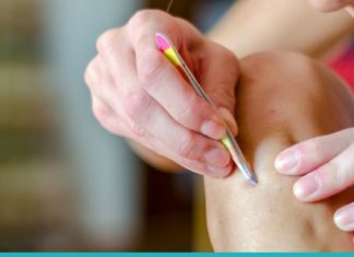 Როგორ ავიცილოთ თავიდან თმის ჩახვევა? სასარგებლო რჩევები