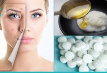 ასპირინის საოცრად ეფექტური ნიღბები სახის კანისთვის