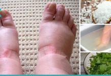 გიშუპდებათ ფეხები? მაშინ სცადეთ ეს ხალხური მეთოდები