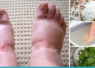 გიშუპდებათ ფეხები? მაშინ სცადეთ ეს ხალხური მეთოდები