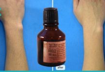 მოიშორეთ არასასურველი თმა იოდის დახმარებით. შედეგი გარანტირებულია!