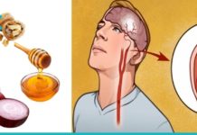 თავის ტვინის სისხლძარღვების გაწმენდის 5 ყველაზე ეფექტური მეთოდი.