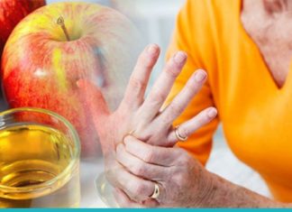 გამოიყენეთ ვაშლის ძმარი სახსრების ტკივილის წინააღმდეგ! თქვენ გაოცდებით შედეგით!