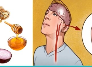 თავის ტვინის სისხლძარღვების გაწმენდის 5 ყველაზე ეფექტური მეთოდი.