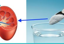 მხოლოდ ნახევარი კოვზი საკვები სოდა და თქვენს თირკმელებს აი, ეს დაემართება-ეფექტურია!