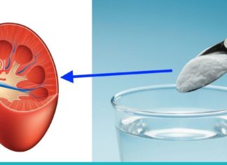 მხოლოდ ნახევარი კოვზი საკვები სოდა და თქვენს თირკმელებს აი, ეს დაემართება-ეფექტურია!