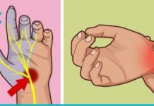 მალამო ართროზისა და სახსრების ტკივილისთვის. ეს საკმაოდ ეფექტური და დროით შემოწმებული რეცეპტია.