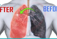 ეწევით? მაშინ ეს რეცეპტი თქვენთვისაა. გაიწმინდეთ ფილტვები სწრაფად და მარტივად