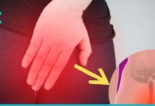 Რა არის თრომბოზული ბუასილი და როგორ ამოვიცნოთ იგი