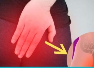 Რა არის თრომბოზული ბუასილი და როგორ ამოვიცნოთ იგი