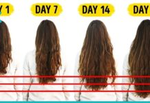 რეცეფტი თმის ზრდითვის, რომლის შედეგით ექიმებიც კი გაოცდნენ