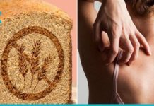 გლუტეინის აუტანლობის სიმპტომები