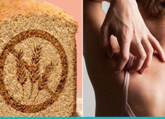 გლუტეინის აუტანლობის სიმპტომები