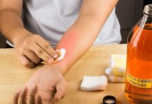 ვაშლის ძმრის გამოყენების საუკეთესო რეცეფტები უამრავი დაავადების განსაკურნად