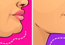 როგორ უნდა მოიშოროთ ღაბაბი? ყველაზე მარტივი და ეფექტური ხერხი რაც აქამდე გსმენიათ