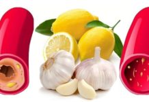 ნიორი და ლიმონი-ყველაზე ეფექტური ნაზავი არტერიების გასუფთავებისთვის!