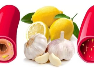 ნიორი და ლიმონი-ყველაზე ეფექტური ნაზავი არტერიების გასუფთავებისთვის!