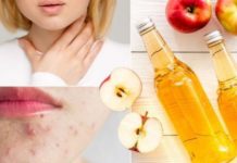 რატომაა სასარგებლო და საჭირო ვაშლის ძმარი? საჭირო ინფორმაცია დიასახლისებისთვის