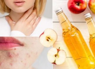 რატომაა სასარგებლო და საჭირო ვაშლის ძმარი? საჭირო ინფორმაცია დიასახლისებისთვის