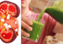 5 არაჩვეულებრივი სასმელი თირკმელების გასაწმენდად! გამოგადგებათ…