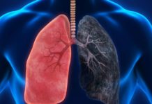 პროდუქტები, რომლებიც ორგანიზმიდან ნიკოტინს გამოდევნიან! გაიგეთ მეტი…