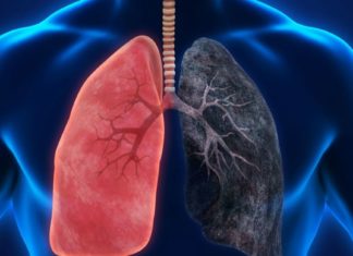 პროდუქტები, რომლებიც ორგანიზმიდან ნიკოტინს გამოდევნიან! გაიგეთ მეტი…