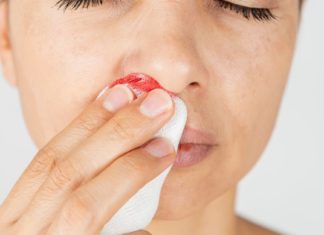 ცხვირიდან სისხლდენას ამ მეთოდებით შეაჩერებთ